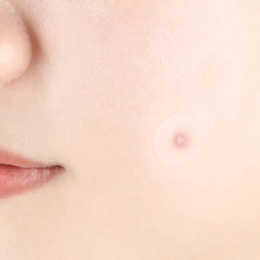 [Pyunkang Yul] Clear Spot Patch (18ea X 4ea) 4